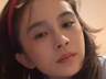 赵樱子自曝把脸部填充都融掉了,只剩假体鼻子无法复原