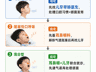 口呼吸≠单纯张嘴睡 家长别搞错首诊科室
