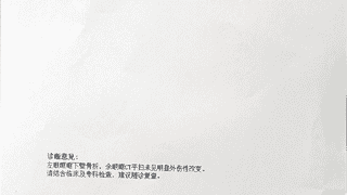 初一学生称劝阻同学纠纷反遭殴打致左眼骨折 伤人者不满14周岁不予行政处罚 教育局:建议通过司法途径维权