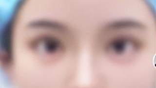 未成年人沉迷动漫美化审美 擅自要求吸脂做人鱼线整形