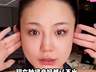 网红婉儿医美翻车,自嘲“关了美颜像孙猴子”