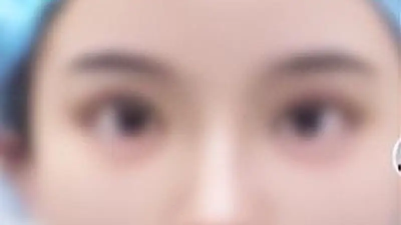 未成年人沉迷动漫美化审美 擅自要求吸脂做人鱼线整形