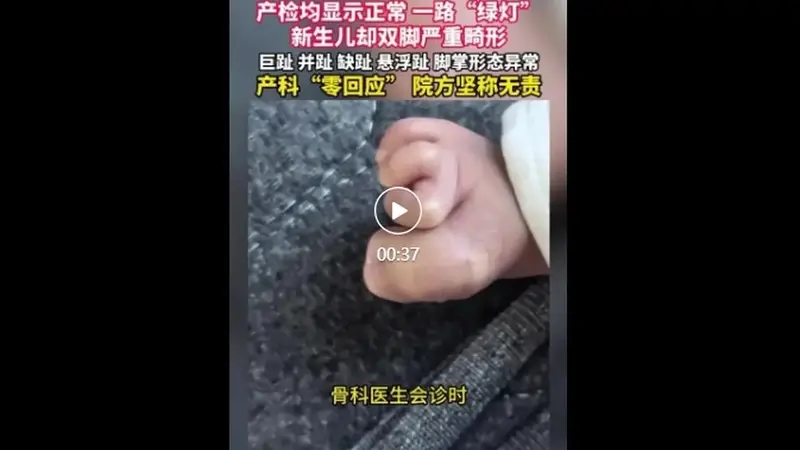 珠海新生儿产检正常出生后双脚严重畸形 院方称属医学盲区主张无责