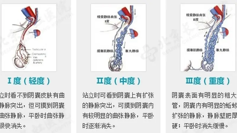 备孕两年无果，28岁杭州男子傻眼：这里竟藏了一窝“蚯蚓”！医生：千万别小看了